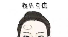 脸上的痣看爱情和婚姻